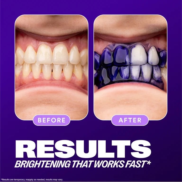 Hismile V34 Colour Corrector, Tooth Stain Concealer, Teeth Whitening Booster, Purple Toothpaste, Color Correcting Technology, V34, Tooth Colour Corrector
